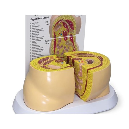 GPI ANATOMICAL Anatomical Model - Obesity 3600